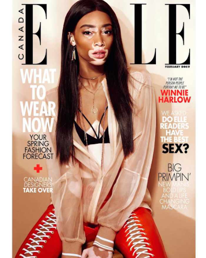 Winnie Harlow 2